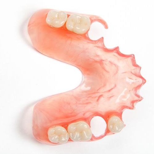 Нейлоновые (гибкие) зубные протезы